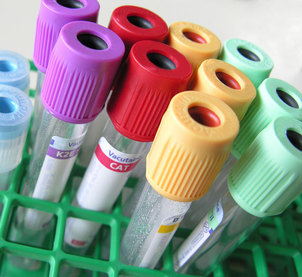 Dietista Viladecans | Farmacia Manuel Montes